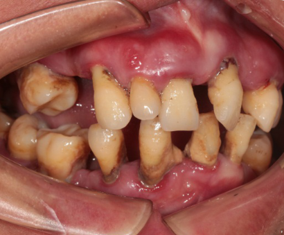 Photos_of_preliminary_oral_diagnosis (2) Photos_of_preliminary_oral_diagnosis (2)