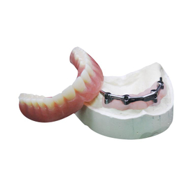 Overdenture