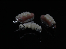 MK1 Dental Attachment