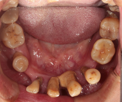Photos_of_preliminary_oral_diagnosis (5)