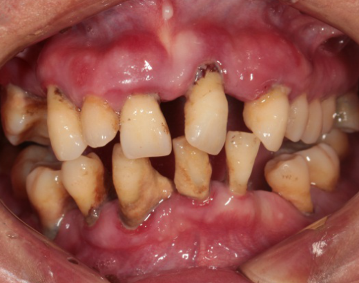 Photos_of_preliminary_oral_diagnosis