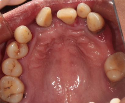 Photos_of_preliminary_oral_diagnosis (4) Photos_of_preliminary_oral_diagnosis (4)