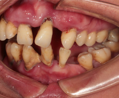 Photos_of_preliminary_oral_diagnosis (3)