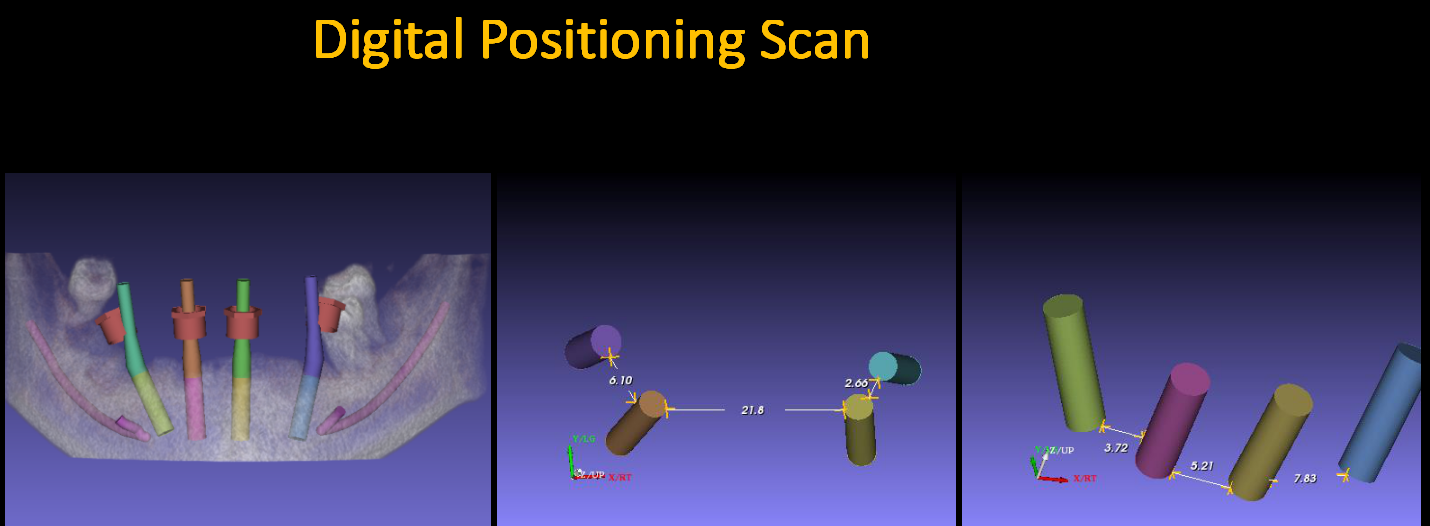 Digital_Positioning_Scan_3