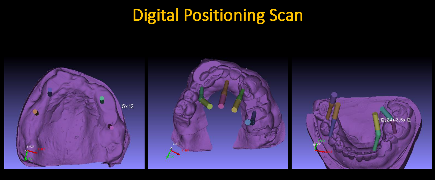 Digital_Positioning_Scan_2